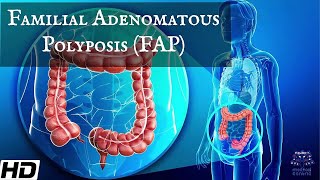 Familial Adenomatous Polyposis  FAP Everything You Need To Know [upl. by Rim]