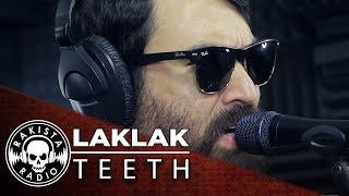 LAKLAK by Teeth  Rakista Live EP148 [upl. by Ripleigh]