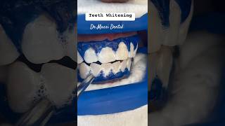 Office Teeth Whiteningzoom teethwhitening music song dance pop viral dentist satisfying f [upl. by Nilyaj399]