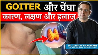 Important Things To Know About Thyroid Goiter  Dr Gaurav Gangwani Interventional Radiologist [upl. by Aramoix]