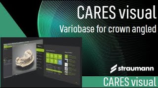 Variobase for Crown AS Angled Solution [upl. by Anod]