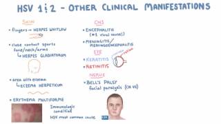 What Can Cause A False Positive Herpes Test [upl. by Sevy768]