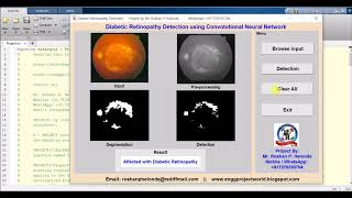 Diabetic Retinopathy Detection Using CNN Matlab Source Code [upl. by Essirahs]