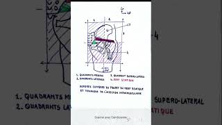 Les repères cliniques du trajet du nerf sciatique et technique de l injection intramusculaire [upl. by Avevoneg]