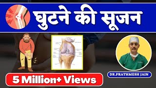 Swelling in Knee JointHindi घुटने की सूजन घुटने में पानी भर गया है Knee Pain and Swelling [upl. by Sabrina]