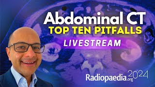 Top ten pitfalls in abdominal CT with Vikas Shah [upl. by Tenner]