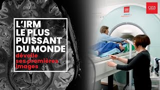 🧠Première mondiale Le cerveau dévoilé comme jamais grâce à l’IRM le plus puissant au monde [upl. by Oivalf939]