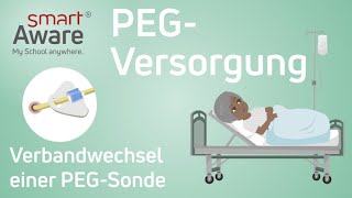 PEGVersorgung Verbandwechsel einer PEGSonde  Fachfortbildungen Pflege  Fortbildungen Pflege [upl. by Koerner]