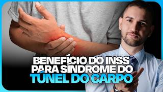 Síndrome do túnel do carpo dá direito de receber auxíliodoença aposentadoria ou auxílioacidente [upl. by Salakcin689]