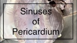 Sinuses of Pericardium Anatomy [upl. by Rozanna]