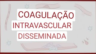 Coagulação intravascular disseminada  causas sintomas diagnóstico tratamento patologia [upl. by Tessa]