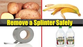 5 Home remedies to remove a Splinter safely [upl. by Woodall928]