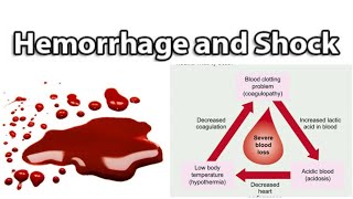 Hemorrhage amp Shock 1  Classification of HemorrhageAmount Estimation Management [upl. by Dorian544]