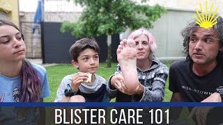 HOW TO CARE FOR BLISTERS  CAMINO DE SANTIAGO VLOG  EP 89 [upl. by Nahtaneoj]