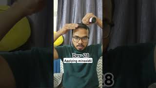 Day 28 Hair Regrowth journey Applying minoxidil bald minoxidil minoxidilresult hairloss [upl. by Yonah282]