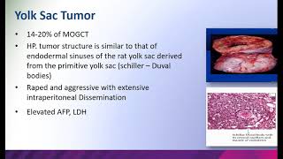 Ovarian Germ Cell Tumor [upl. by Carroll67]