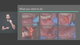 Incisional and excisional biopsies [upl. by Aned]