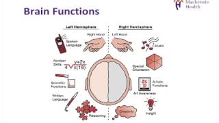 Stroke Education  Causes and Effects [upl. by Enobe]