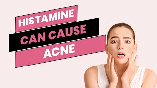 Histamine can cause acne acnetreatment acneproblems histamine histamineintolerance estrogen [upl. by Lidaa9]