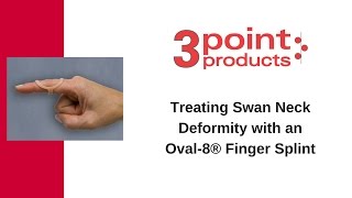 How to Treat Swan Neck Deformity with an Oval8 Finger Splint  3Point Products [upl. by Ysnap446]