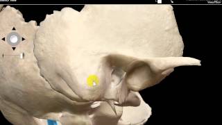 MASTOID ANTRUM BY DR SAMEH GHAZY [upl. by Redlac]