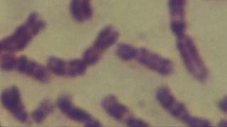 Cytogenetics Human chromosomes Karyotype [upl. by Yeldarb]