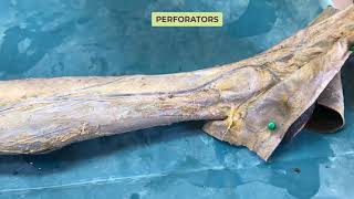 Great Long saphenous vein Gross and Clinical Anatomy [upl. by Marrilee]