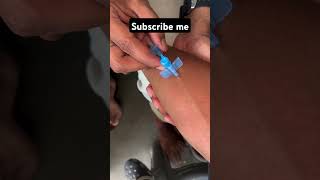 IV Cannula Insertion how To Insert IV Cannula doctor mbbs youtubeshorts ytshorts neet viral [upl. by Fadas631]