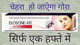 Elosone HT Cream Review Side Effects UsesBest Fairness Cream For Marks [upl. by Viridi]