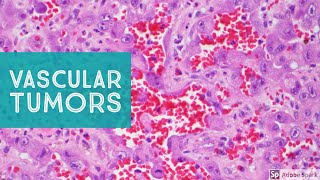 Vascular Tumors of the Skin  Explained by a Soft Tissue Pathologist [upl. by Aynam]