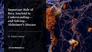 Important Role of Beta Amyloid to Alzheimers Disease [upl. by Garlan81]