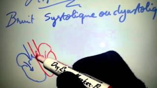 Astuce  bruit systolique ou diastolique   Dr Astuce [upl. by Terrag]