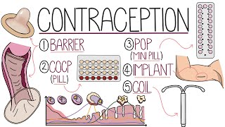 Methods of Contraception Made Easy Contraceptive Methods Explained [upl. by Briny]