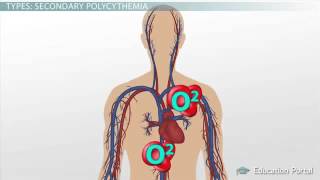 Polycythemia Definition amp Causes [upl. by Hnib557]