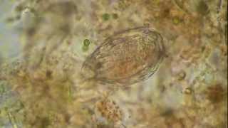 Rotifer under the microscope [upl. by Runkle]