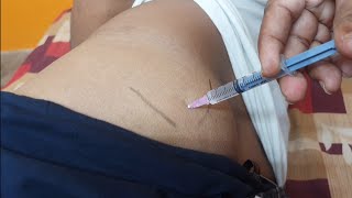 IM इंजेक्शन देने का सही तरीका  Easy steps to give Intramuscular injection  IM injection technique [upl. by Ekal]