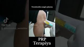 prptherapy dizağrısı arthrosis [upl. by Erund]