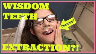 WISDOM TEETH EXTRACTION ROAD TO RECOVERY  28 MONTHS UPDATE [upl. by Lledroc305]