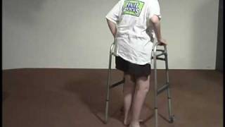 Abnormal Gait Exam  Neuropathic Gait [upl. by Euqimod]