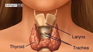 Štitna žlijezda Otkrijte sami prve znakove bolesti 21042018 [upl. by Ettevram]