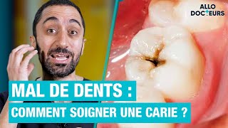 🦷 Comment soigner une CARIE  Les réponses du Dr Jimmy Mohamed [upl. by Anifesoj107]