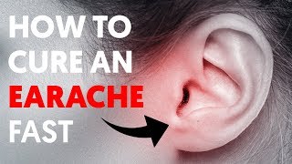 The 5 Quickest Way to Relieve Earaches [upl. by Mundt]