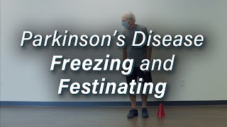 Parkinsons Disease Freezing amp Festinating Gait [upl. by Zollie237]