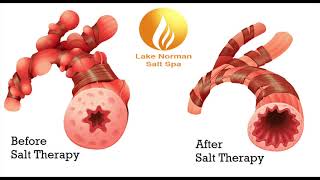 Halotherapy Explained LKNSaltSpa [upl. by Annahsat]