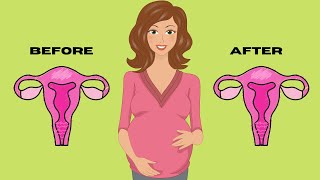 13 Home Remedies to Unblock Fallopian Tube  Get Pregnant Fast [upl. by Nahtaoj]