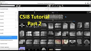 Carestream Imaging Version 8 Tutorial  Part 2 [upl. by Toomay]