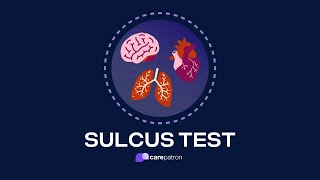 Sulcus Test [upl. by Maddeu]