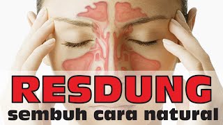 RESDUNG CARA MUDAH UNTUK SEMBUH SECARA NATURAL  Dr Noordin Darus [upl. by Htessil]