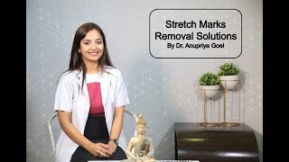 Stretch Marks Removal Solutions By Dr Anupriya Goel [upl. by Noreen258]