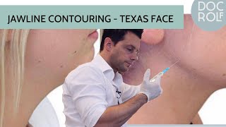 JAWLINE CONTOURING  Texas Face Behandlung  Dr Rolf Bartsch [upl. by Riffle272]